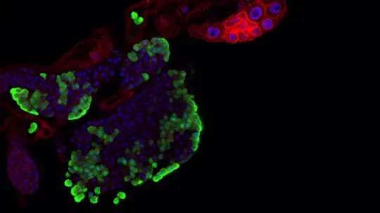 Un estudio en Drosophila revela cómo el sistema inmune ajusta el desarrollo ante el exceso de azúcar