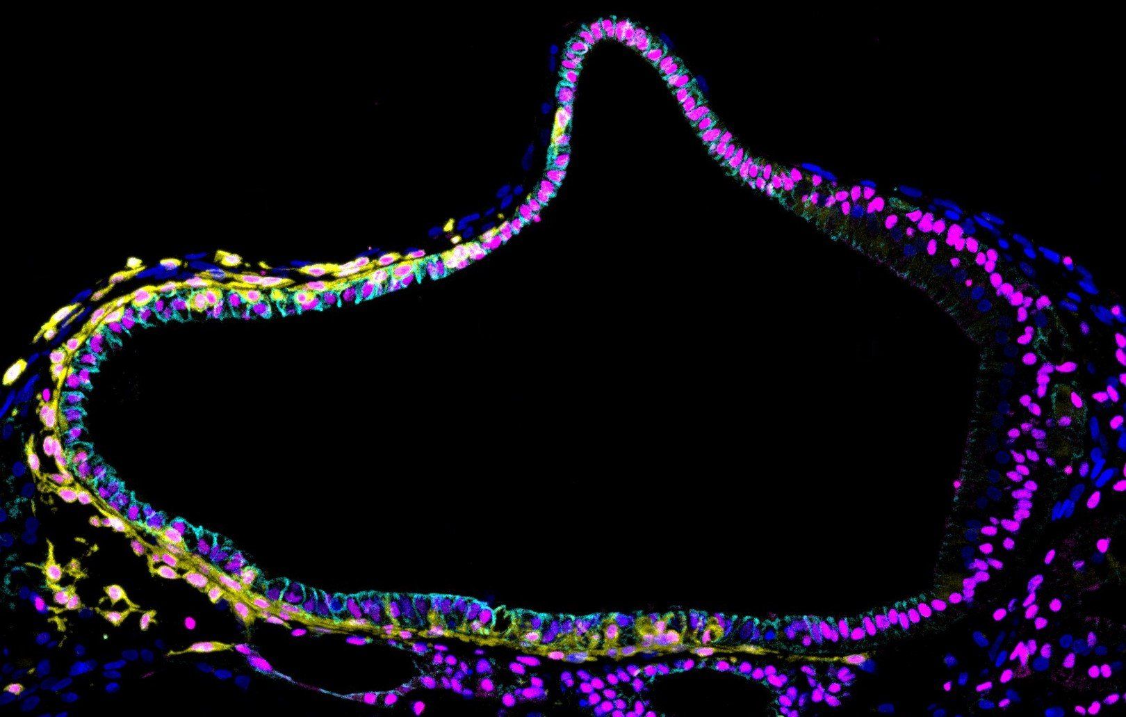 In het lab gekweekte ‘mini-oortjes’ helpen om gehoorverlies beter te begrijpen