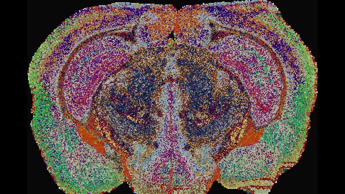 The first map of lipids in the mouse brain