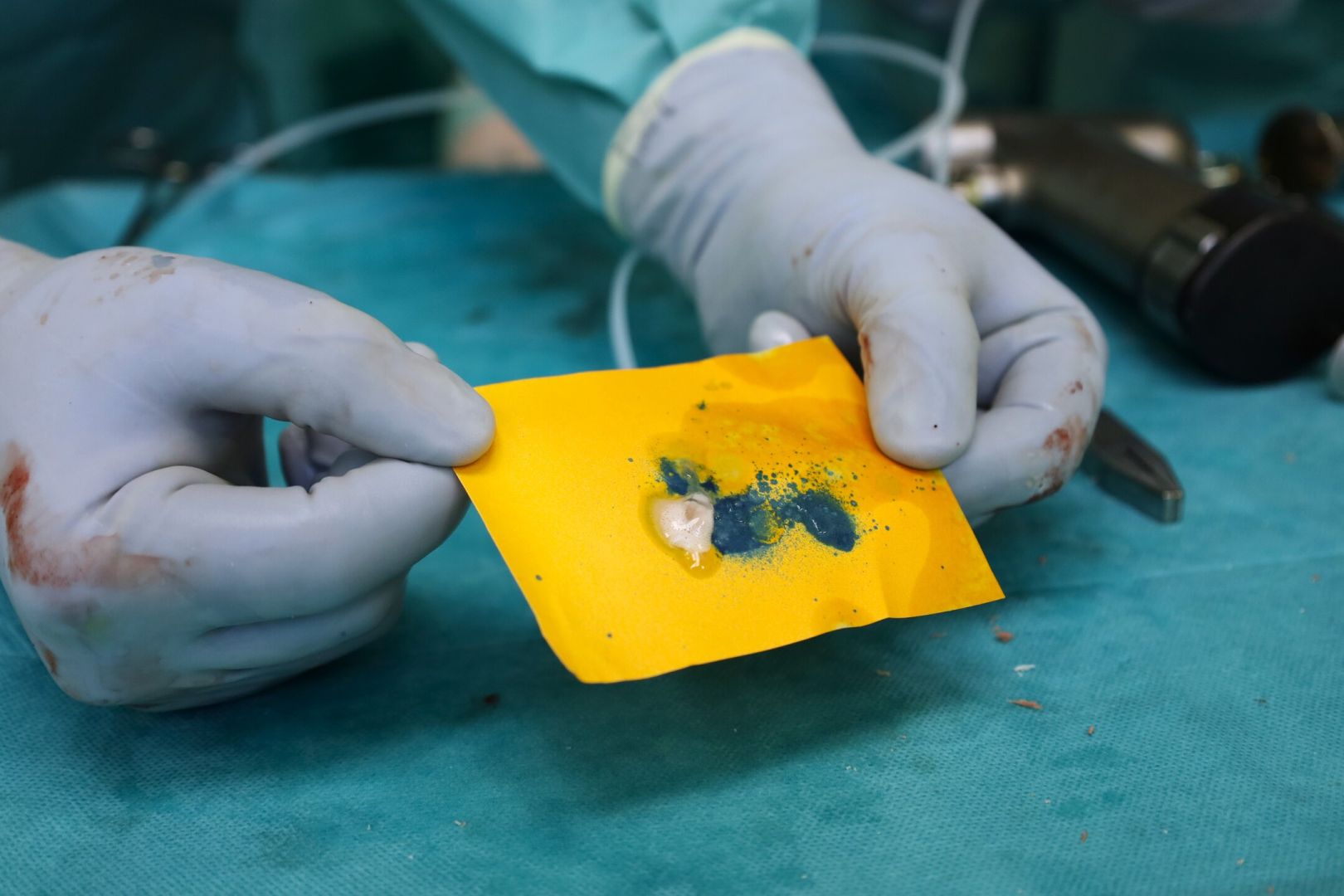 Žilinská ortopédia využíva pri operáciách inovatívnu biologickú metódu