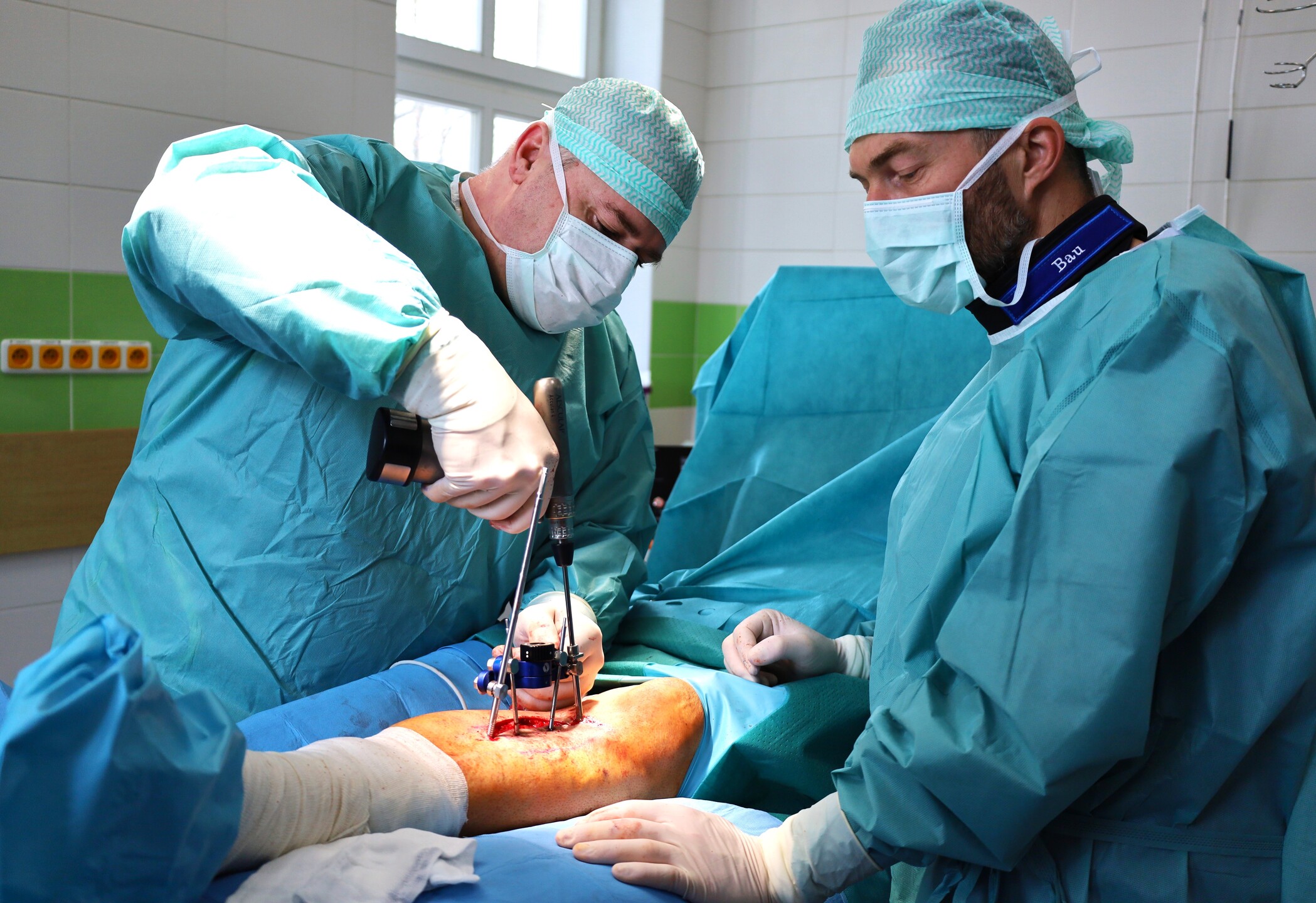 Žilinská nemocnica prináša unikátnu liečbu pacientov, ktorým hrozí amputácia končatín