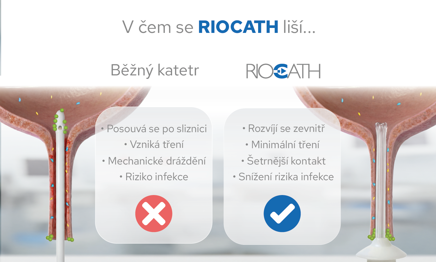 Mohla moderní česká technologie Riocath zabránit fatální urosepsi?