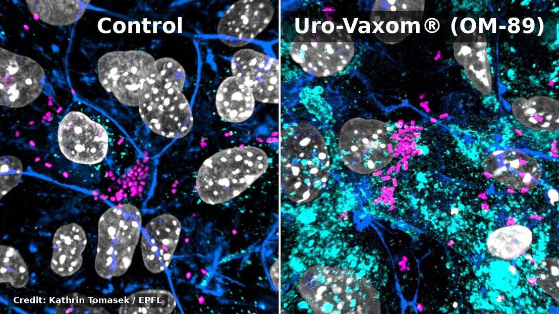 Helping bladder cells to clear urinary infections