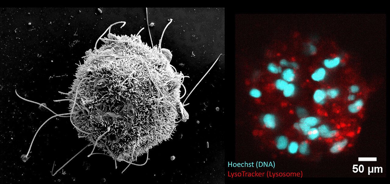 Meeresbiologie: Veröffentlichung in Nature Communications Schon wirbellose Tiere können spezifisch Krankheitserreger erkennen