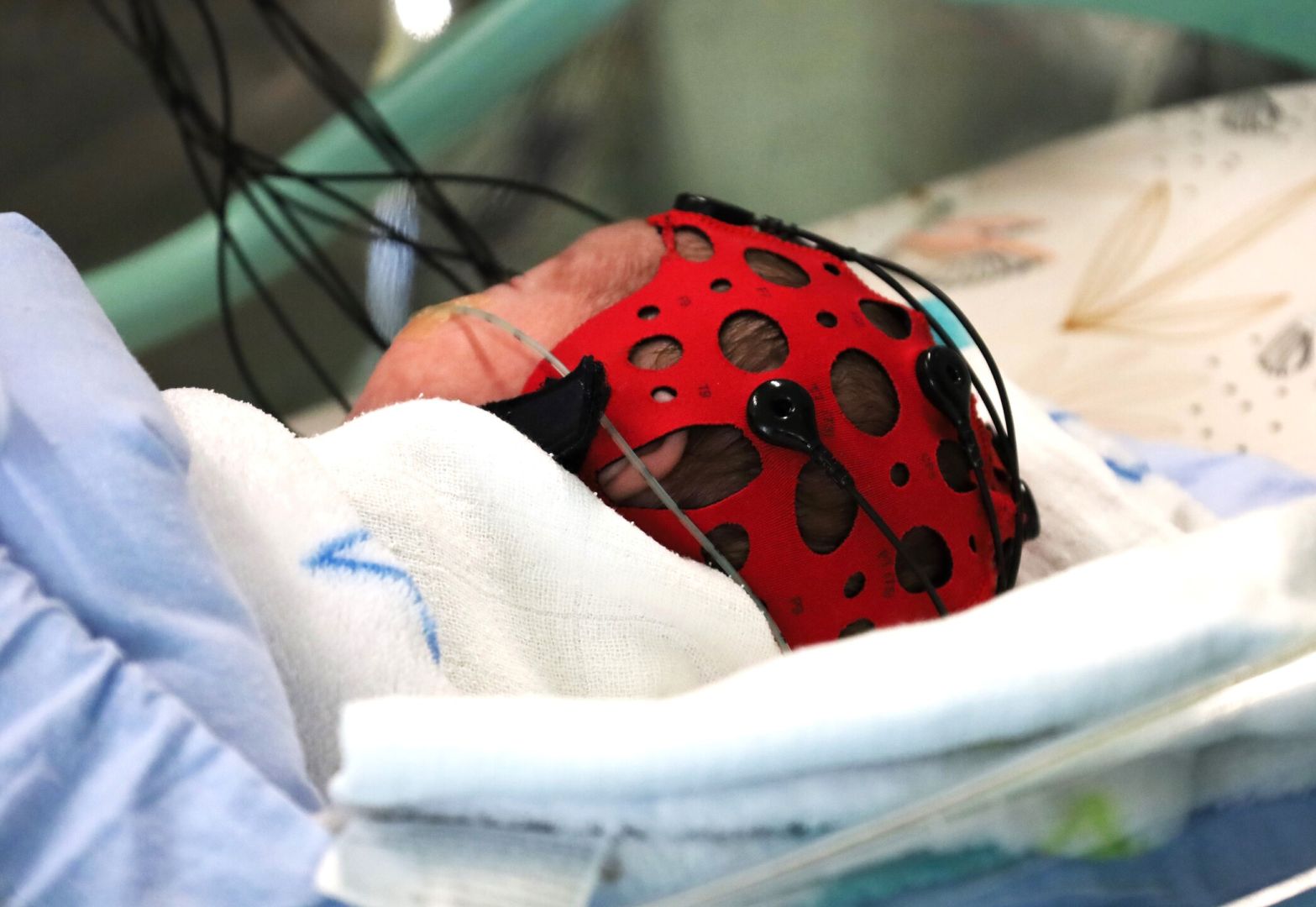 Nový EEG prístroj posilňuje starostlivosť o najmenších pacientov na oddelení neonatológie