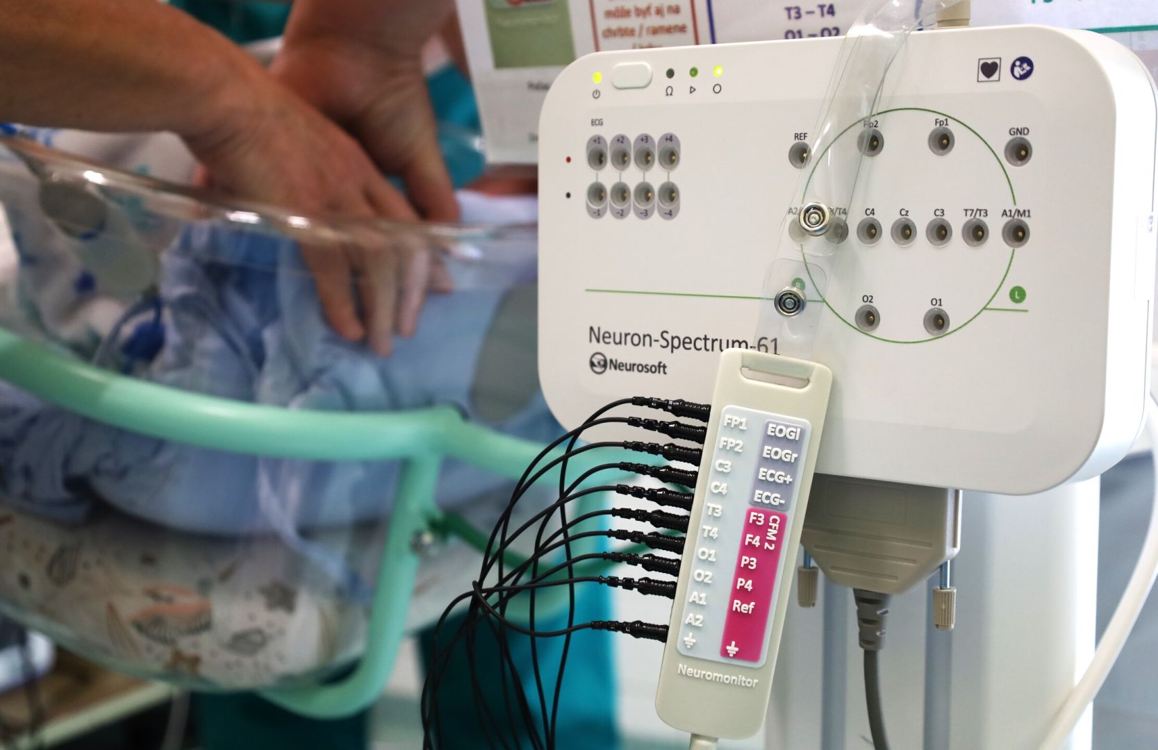 Nový EEG prístroj posilňuje starostlivosť o najmenších pacientov na oddelení neonatológie