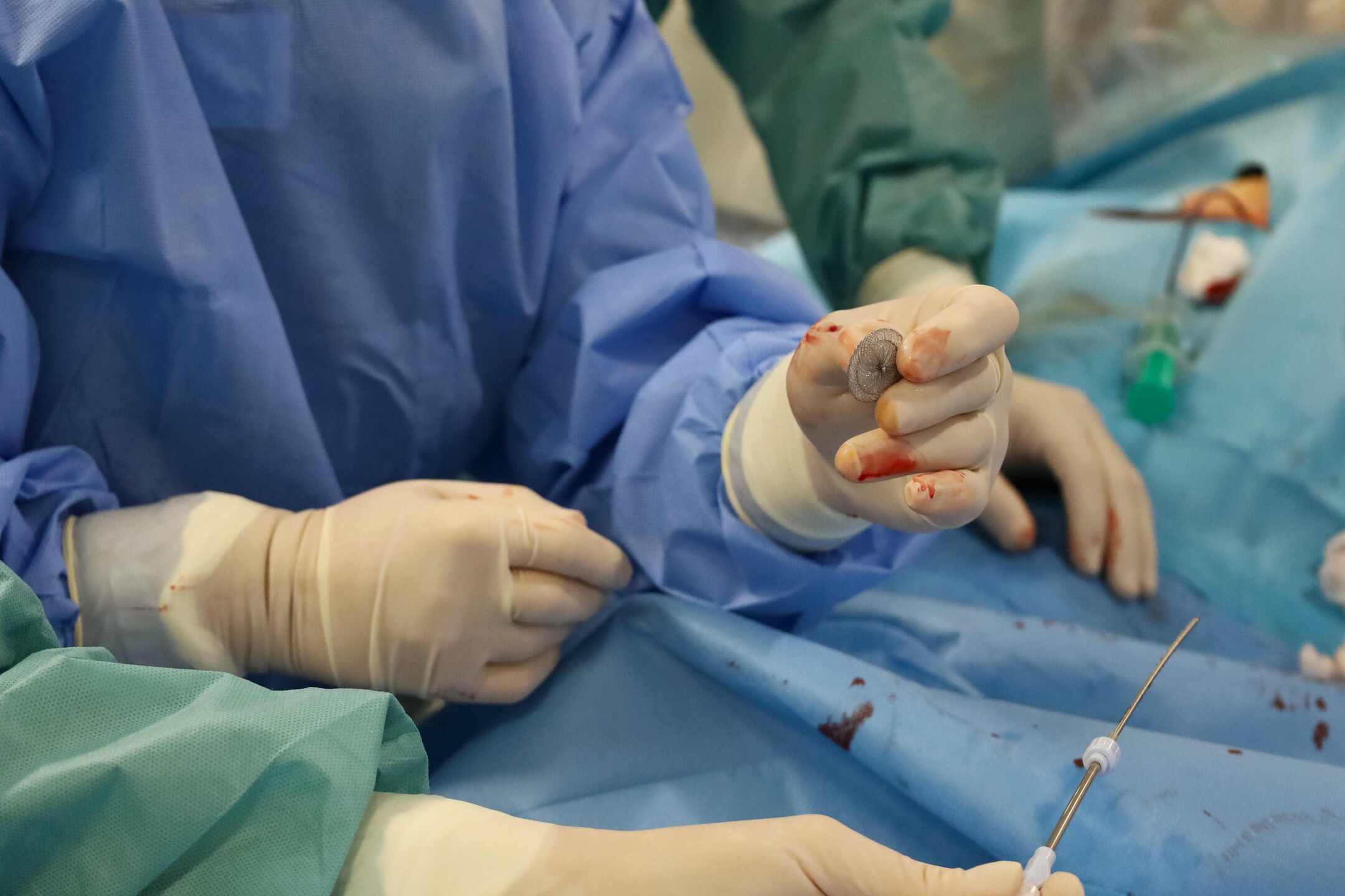 Žilinská nemocnica rozšírila program intervenčnej kardiológie o ďalšie výkony