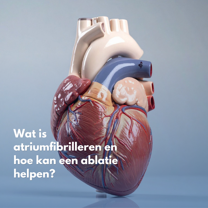 Hart & Vaat | Wat is atriumfibrilleren en hoe kan een ablatie helpen?
