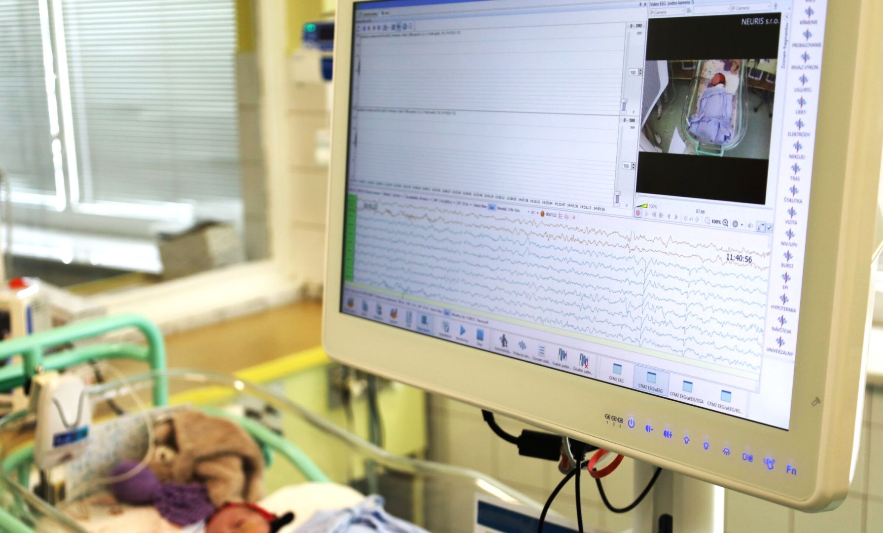 Nový EEG prístroj posilňuje starostlivosť o najmenších pacientov na oddelení neonatológie