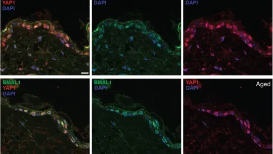 Aging reprograms skin genetic activity and promotes inflammation