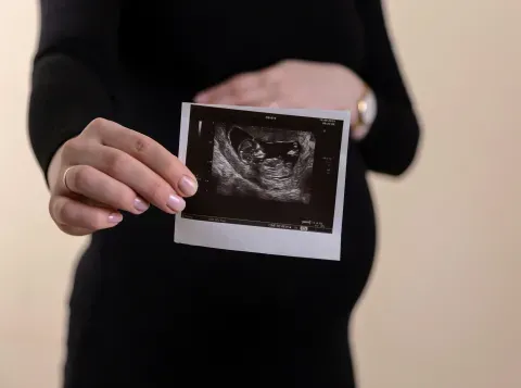 Nieuwe huurder op Science Park: SPN zorgt voor goede prenatale screening