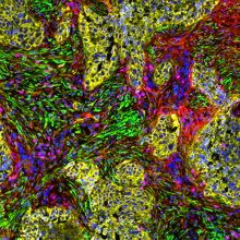 Bispezifische Antikörper für die Krebstherapie: Bindegewebe des Tumors im Visier