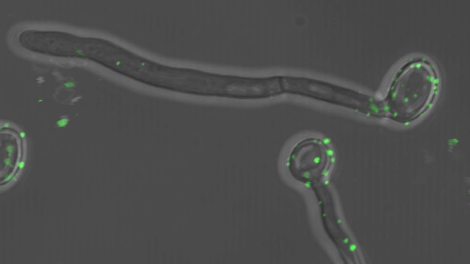 Immunabwehr mit Kehrseite