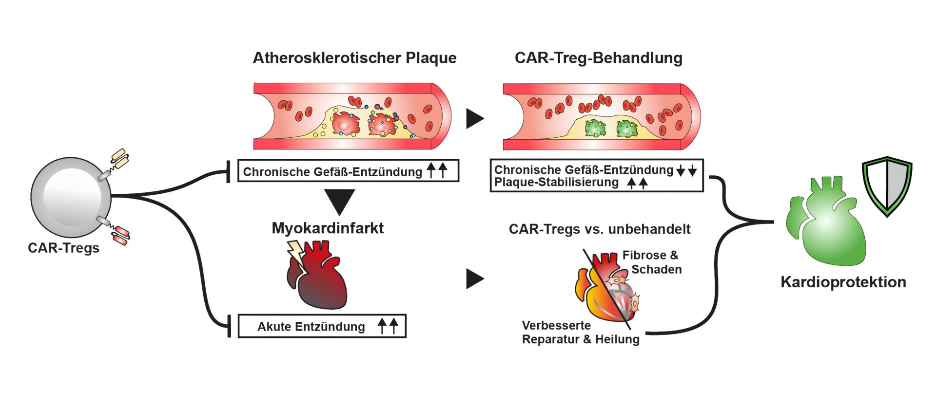 Neue Ära der Immunzelltherapie: CAR-T-Zellen könnten künftig das Herz schützen