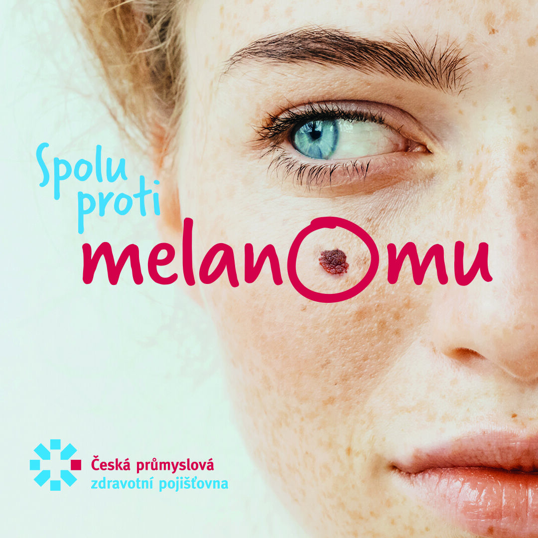 „Spolu proti melanomu“ nabídne zdarma i vyšetření zraku